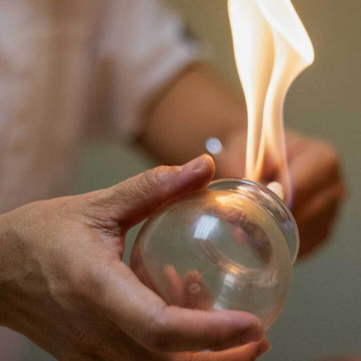 cupping chinese therapy
