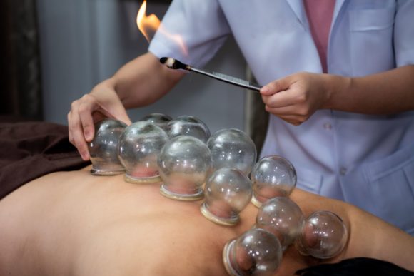 Traditional Chinese Medicine